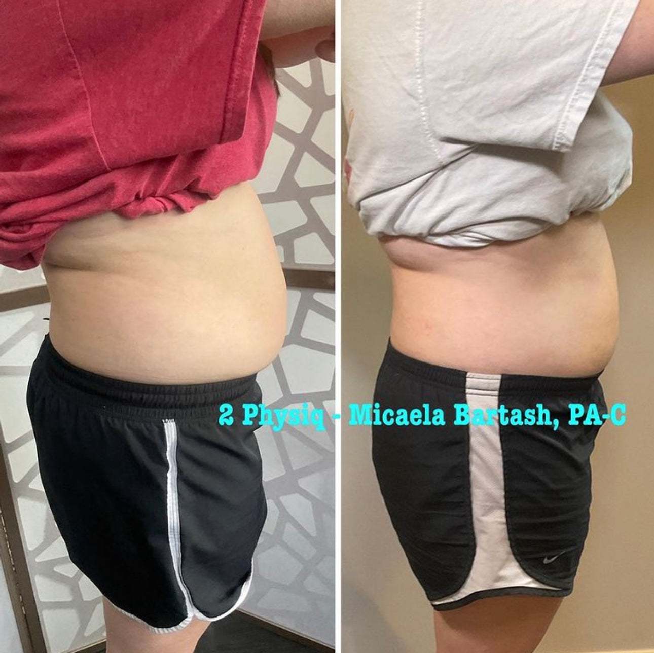 PHYSIQ Body Contouring Buy two get one free