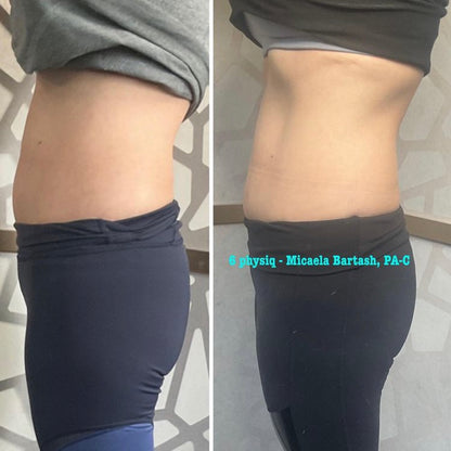 PHYSIQ Body Contouring Buy two get one free