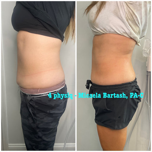 PHYSIQ Body Contouring Buy two get one free